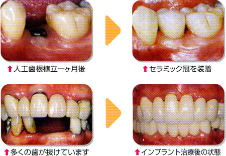 施術例